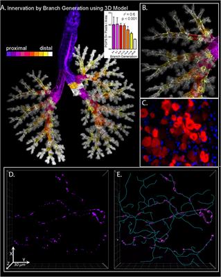 Airway Sensory Nerve Plasticity in Asthma and Chronic Cough